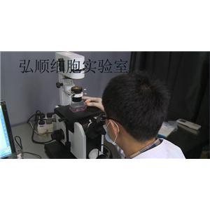 GIST-430细胞：人胃肠道间质瘤细胞,GIST-430 Cell