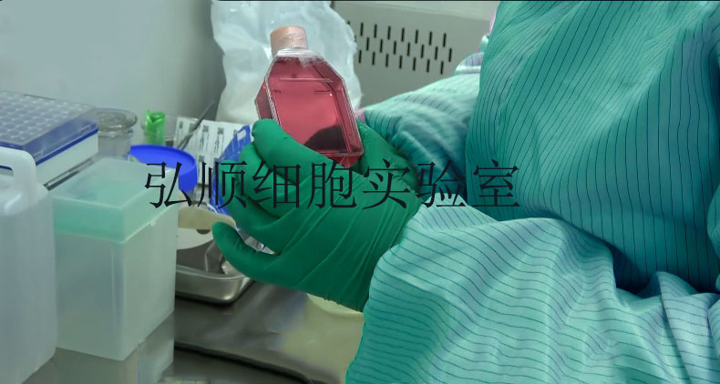 NCI-H295R细胞：人肾上腺皮质腺癌细胞,NCI-H295R Cell