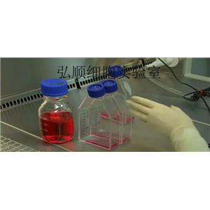 NCI-H929细胞：人浆细胞白血病细胞
