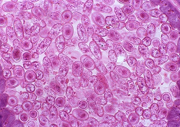 血管内皮内皮细胞图片