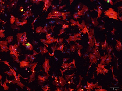 小鼠肝星状细胞培养试剂盒