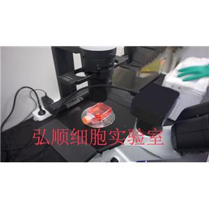 QGY7703|人肝癌细胞,QGY7703 Cell