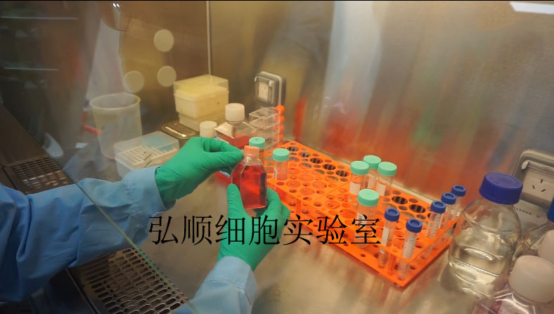 HCFB|人心肌成纤维细胞,HCFB Cell