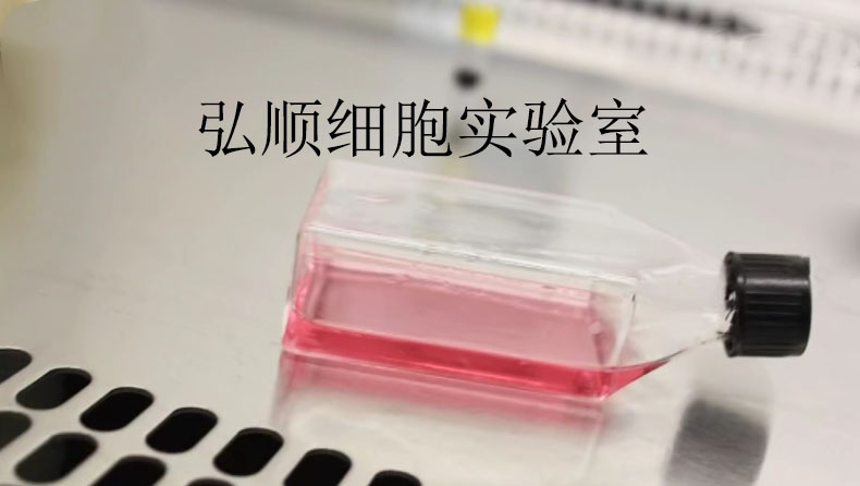 HCT-8 Cell；人结肠癌细胞,HCT-8 Cell