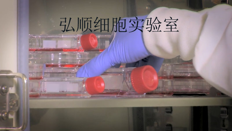 LS123 Cell；人结肠腺癌细胞,LS123 Cell