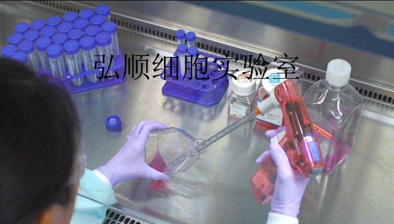 HCT-8 Cell<人结肠癌细胞系>,HCT-8 Cell