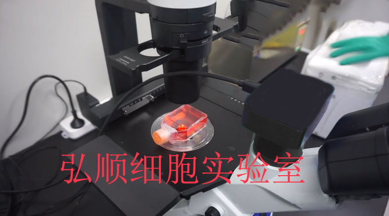 HULEC-5a Cell Line|人肺微血管内皮细胞,HULEC-5a Cell Line