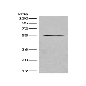 Anti-ASIC1 antibody