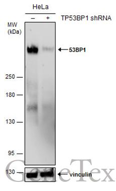 53BP1 antibody