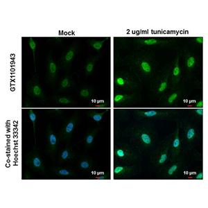 ATF4 antibody