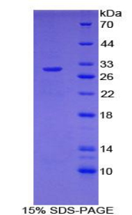 107kDa核孔蛋白(NUP107)重组蛋白,Recombinant Nucleoporin 107kDa (NUP107)