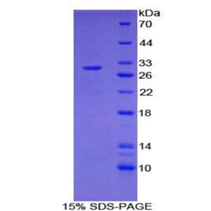 107kDa核孔蛋白(NUP107)重组蛋白,Recombinant Nucleoporin 107kDa (NUP107)