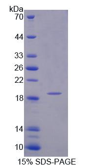 107kDa肌醇多聚磷酸-4-磷酸酶Ⅰ型(INPP4A)重组蛋白,Recombinant Inositol Polyphosphate-4-Phosphatase Type I 107kDa (INPP4A)