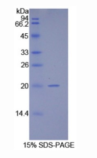 10kDa热休克蛋白1(HSP10)重组蛋白,Recombinant Heat Shock 10kDa Protein 1 (HSP10)