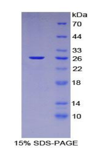 133kDa核孔蛋白(NUP133)重组蛋白,Recombinant 11-Beta-Hydroxysteroid Dehydrogenase Type 1 (HSD11b1)
