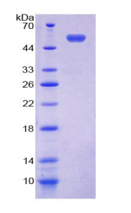 153kDa核孔蛋白(NUP153)重组蛋白,Recombinant Nucleoporin 153 (NUP153)