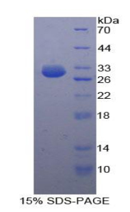 160kDa核孔蛋白(NUP160)重组蛋白,Recombinant Nucleoporin 160 (NUP160)