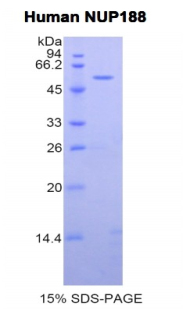 188kDa核孔蛋白(NUP188)重组蛋白,Recombinant Nucleoporin 188kDa (NUP188)