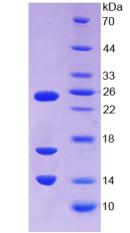 18kDa阳离子抗菌肽(CAMP)重组蛋白,Recombinant Cathelicidin Antimicrobial Peptide (CAMP)