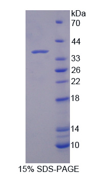 214kDa核孔蛋白(NUP214)重组蛋白,Recombinant Nucleoporin 214kDa (NUP214)