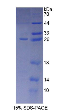 23kDa突触关联蛋白(SNAP23)重组蛋白,Recombinant Synaptosomal Associated Protein 23kDa (SNAP23)