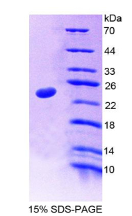 35kDa核孔蛋白(NUP35)重組蛋白,Recombinant Nucleoporin 35kDa (NUP35)