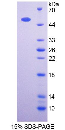 3-琥珀酰辅酶A转移酶1(OXCT1)重组蛋白,Recombinant 3-Oxoacid Coenzyme A Transferase 1 (OXCT1)