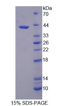 3-羥基丁酸脫氫酶1(BDH1)重組蛋白,Recombinant 3-Hydroxybutyrate Dehydrogenase 1 (BDH1)