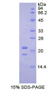 43kDa Tar DNA結(jié)合蛋白(TDP43)重組蛋白,Recombinant Tar DNA Binding Protein 43kDa (TDP43)