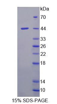 4-羟基苯丙酮酸双加氧酶(HPD)重组蛋白,Recombinant 4-Hydroxyphenylpyruvate Dioxygenase (HPD)