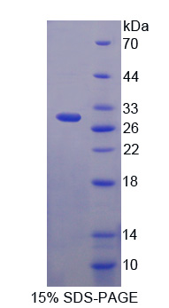 62kDa核孔蛋白(NUP62)重组蛋白,Recombinant Nucleoporin 62 (NUP62)