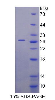 70kDa熱休克蛋白12B(HSPA12B)重組蛋白,Recombinant Heat Shock 70kDa Protein 12B (HSPA12B)