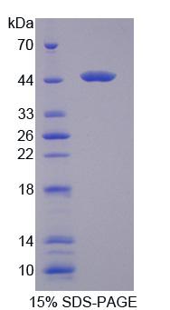 70kDa热休克蛋白6(HSPA6)重组蛋白,Recombinant Heat Shock 70kDa Protein 6 (HSPA6)