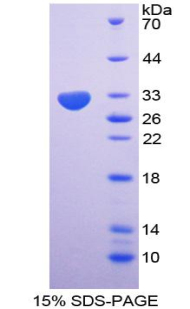 85kDa核孔蛋白(NUP85)重组蛋白,Recombinant Nucleoporin 85 (NUP85)