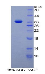 88kDa核孔蛋白(NUP88)重組蛋白,Recombinant Nucleoporin 88 (NUP88)