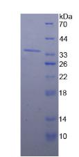 98kDa核孔蛋白(NUP98)重組蛋白,Recombinant Nucleoporin 98 (NUP98)