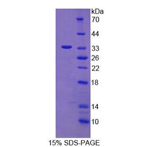 110kDa中心体蛋白(CEP110)重组蛋白,Recombinant Heat Shock 10kDa Protein 1 (HSP12)