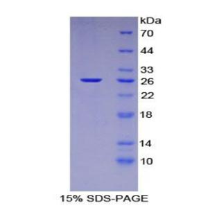 133kDa核孔蛋白(NUP133)重组蛋白