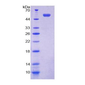 153kDa核孔蛋白(NUP153)重组蛋白,Recombinant Nucleoporin 153 (NUP153)