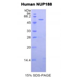188kDa核孔蛋白(NUP188)重组蛋白