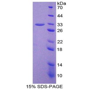 37kDa核孔蛋白(NUP37)重组蛋白,Recombinant Nucleoporin 37 (NUP37)