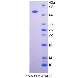 3-琥珀酰辅酶A转移酶1(OXCT1)重组蛋白,Recombinant 3-Oxoacid Coenzyme A Transferase 1 (OXCT1)