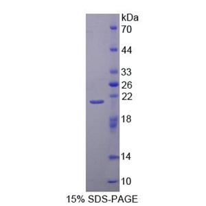 40kDa熱休克蛋白2(HSPF2)重組蛋白