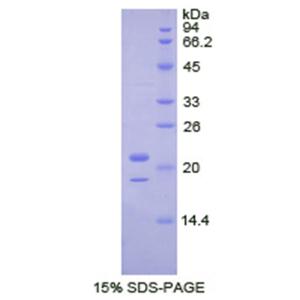 43kDa Tar DNA结合蛋白(TDP43)重组蛋白