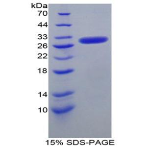 50kDa核孔蛋白(NUP50)重组蛋白,Recombinant Nucleoporin 50kDa (NUP50)