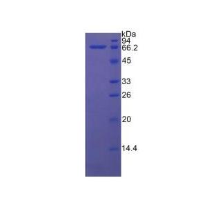 70kDa热休克蛋白1A(HSPA1A)重组蛋白