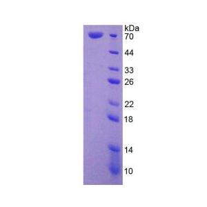 70kDa热休克蛋白1样蛋白(HSPA1L)重组蛋白,Recombinant Heat Shock 70kDa Protein 1 Like Protein (HSPA1L)