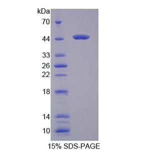 70kDa热休克蛋白6(HSPA6)重组蛋白
