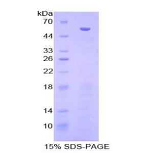 70kDa热休克蛋白结合蛋白1(HSPBP1)重组蛋白