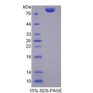 75kDa热休克蛋白(HSP75)重组蛋白,Recombinant Heat Shock Protein 75kDa, Mitochondrial (HSP75)